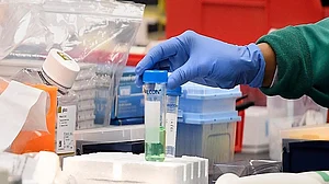 अच्छी खबर: पहली कोरोना वैक्सीन का 100 लोगों पर ट्रायल पूरा, जानें क्या आया रिजल्ट