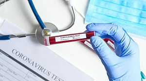 कोरोना का सबसे बुरा दौर आना अभी बाकी! कम्युनिटी ट्रांसफर का भी खतरा, AIIMS निदेशक ने चेताया