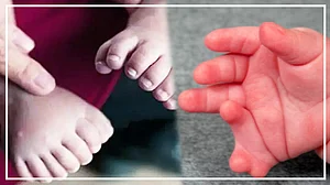 वीडियो: 33 अंगुलियों के साथ पैदा हुई बच्ची, इलाज कर रहे डॉक्टरों के भी उड़े होश!