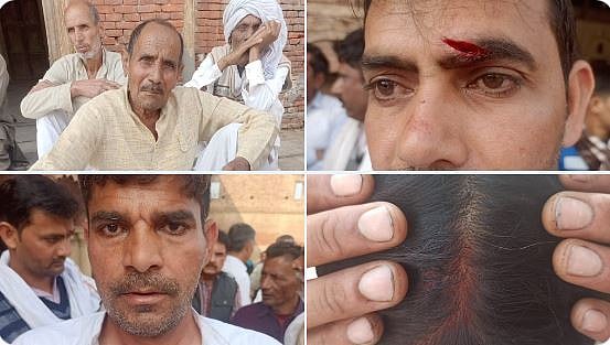 मुजफ्फरनगर में संजीव बालियान के विरोध पर किसानों से मारपीट, तीन घायल, जयंत चौधरी ने बीजेपी को दी नसीहत