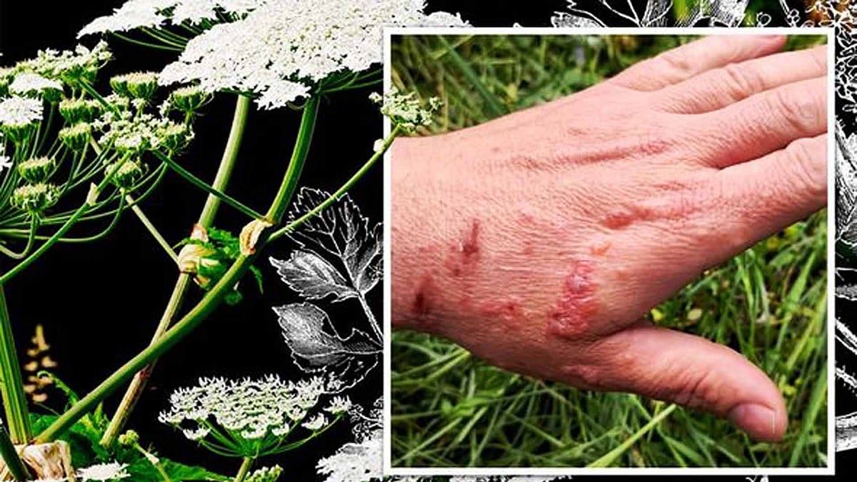 वीडियो: वो पौधा जो सांप से भी ज्‍यादा है जहरीला,  सिर्फ छू लेने से हो सकती है आपकी मौत!