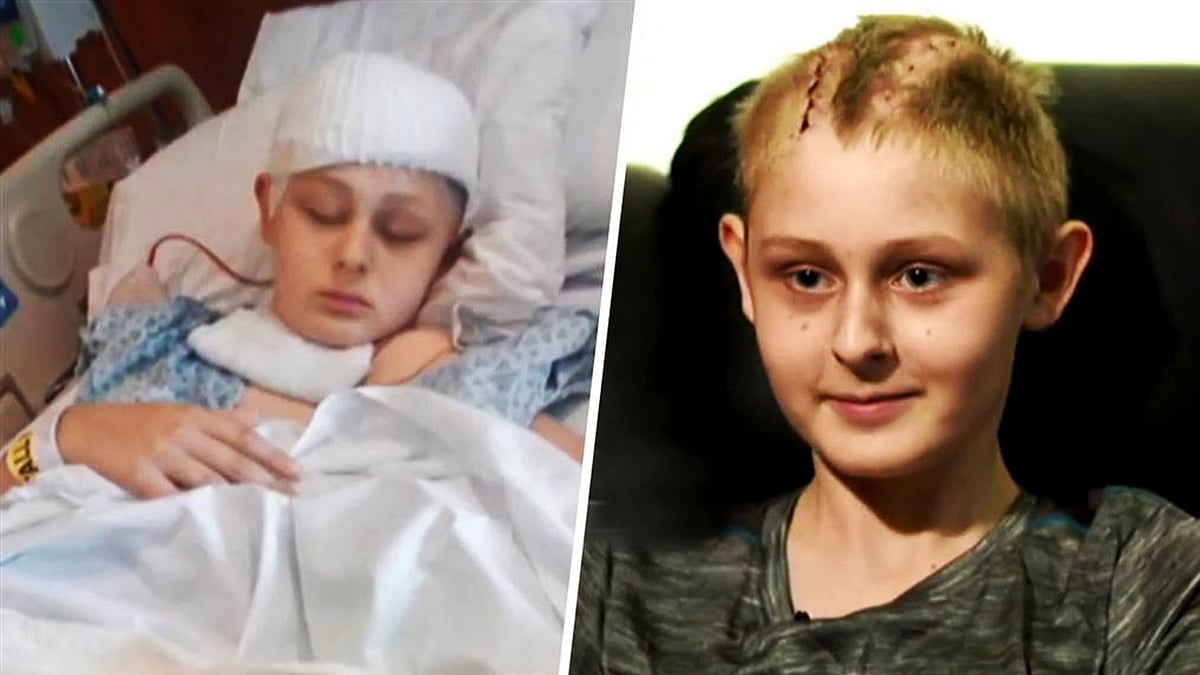 वीडियो: चमत्कार! ब्रेनडेड शख्‍स के अंगदान की चल रही थी तैयारी, फिर अचानक हो गया जिंदा