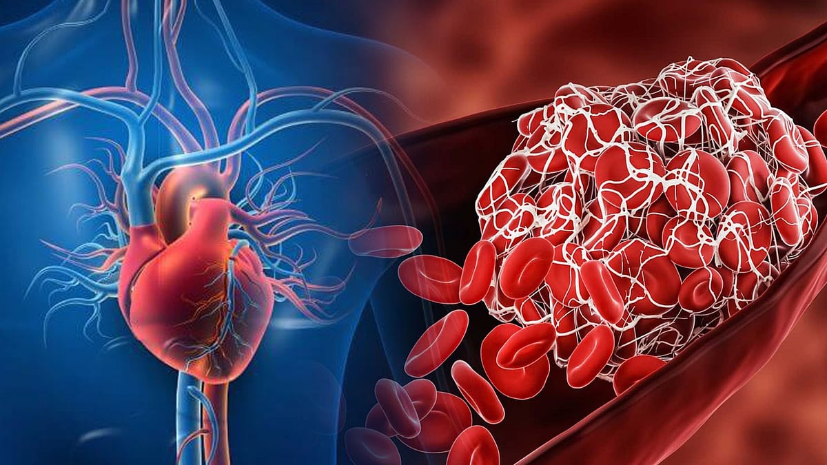 कोरोना के रिस्क फैक्टर को लेकर नया खुलासा! ये सिर्फ फेफड़ों की बीमारी नहीं, पैदा कर सकता है खतरनाक ब्लड क्लॉट