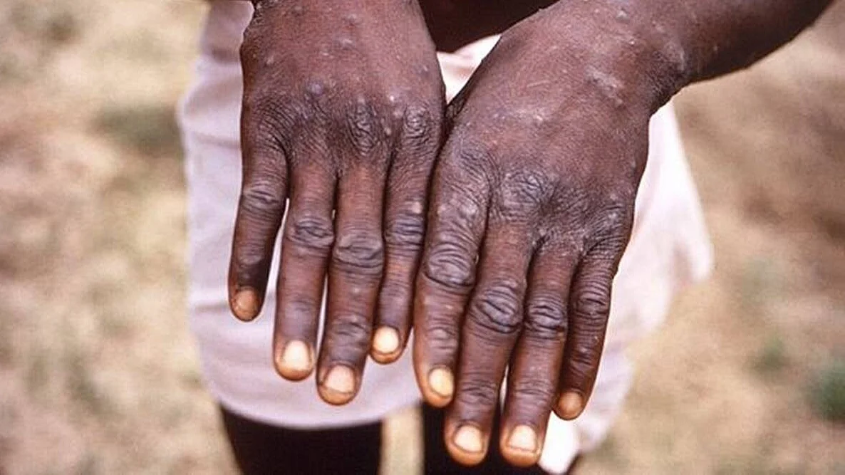 फोटो: सोशल मीडिया