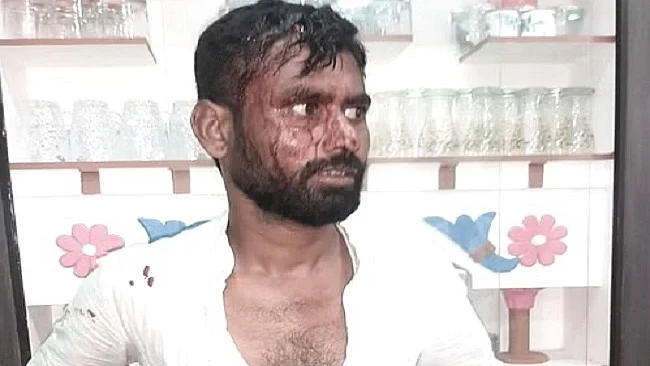 कर्नाटक चुनाव की वोटिंग के दौरान बेल्लारी ग्रामीण में बीजेपी कार्यकर्ताओं के हमले में कांग्रेस नेता घायल