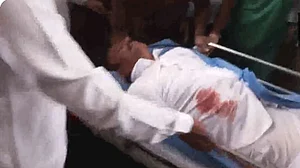तेलंगाना चुनावः प्रचार के दौरान BRS सांसद पर चाकू से हमला, अस्पताल में भर्ती, हमलावर को समर्थकों ने पकड़ा