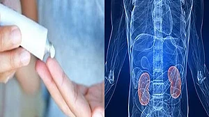 सावधान! फेयरनेस क्रीम से देश में बढ़ रही किडनी की समस्या, एक अध्ययन में खुलासा