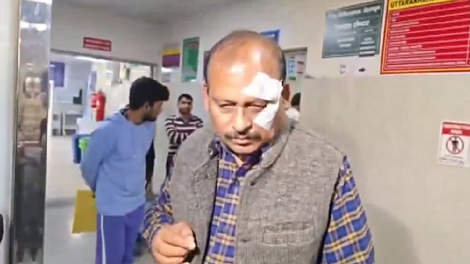 उत्तराखंडः बीजेपी विधायक ने समर्थकों के साथ प्रारंभिक शिक्षा निदेशक पर बोला हमला, गंभीर रूप से घायल किया