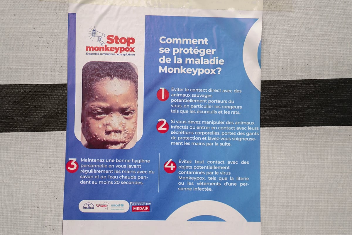 Sweden reports 1st case of more infectious form of mpox first identified in Congo Sweden reports 1st case of more infectious form of mpox first identified in Congo