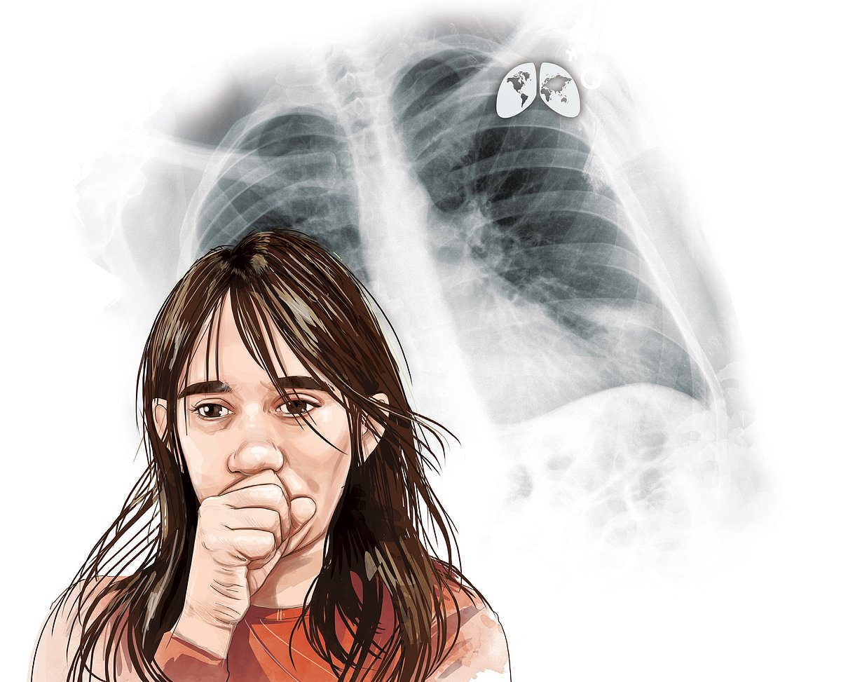 On the fight to stop pneumonia