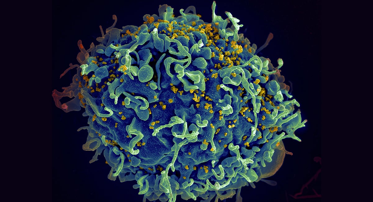 UN warns four million could die from HIV by 2029 if US aid cuts aren’t offset UN warns four million could die from HIV by 2029 if US aid cuts aren’t offset