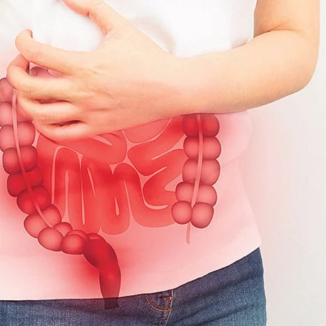 Coping with IBS: Understanding the invisible condition, finding relief