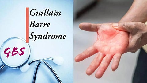 Guillain-Barre First Case Reported In Hyderabad; Woman Critical 