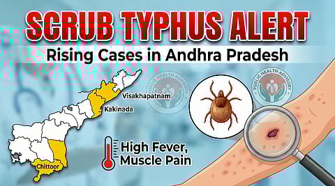 Scrub Typhus Alert: Andhra Sees Rise in Cases, Vigilance Urged