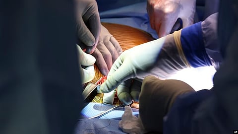 Pig Kidney Transplant to Human:- Doctors in Boston say they have successfully transplanted a genetically modified pig kidney into a 62-year-old patient with end-stage kidney disease.[VOA]