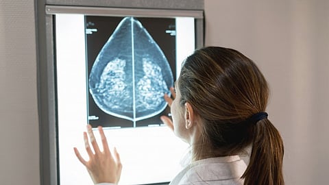 Cancer Risk Prediction: A new publication by a national collective of researchers has highlighted the potential for the use of artificial intelligence [Newswise]