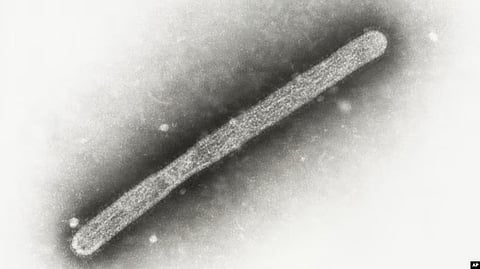 Bird flu virus: The U.S. Centers for Disease Control and Prevention said on Thursday its analysis of samples from the first severe case of bird flu in the country last week [VOA]