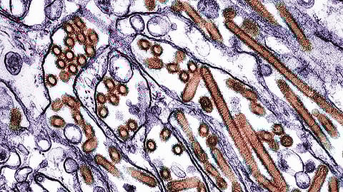 Bird Flu: Officials from the Los Angeles County Department of Public Health reported that several cats tested positive for the bird flu, also called H5N1, after drinking raw milk. [Newswise]