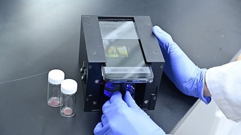 Bladder Cancer: Bladder cancer has a cure rate of over 90% when detected early, but it has a high recurrence rate of 70%, necessitating continuous monitoring. [Newswise]