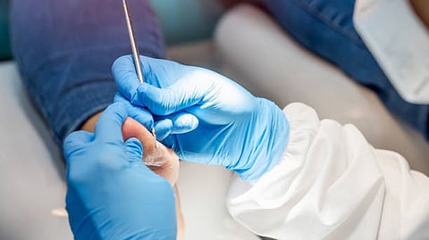 HPV Screening: Genital human papillomavirus is the most common sexually transmitted infection in the United States and is thought to be responsible for more than 99% of cervical cancers. [Pixabay]