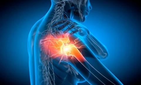 Shoulder Pain: Shoulders are, in many ways, a marvel. One shoulder has four separate joints, packed with muscles [Pixabay]