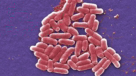 E. Coli Outbreak: Colton George felt sick. The 9-year-old Indiana boy told his parents his stomach hurt. [KFFHealthNews]
