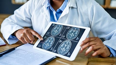 Brain Tumors: Brain tumors are complex conditions that affect the brain and spinal cord and require expert diagnosis and treatment. [Pixabay]