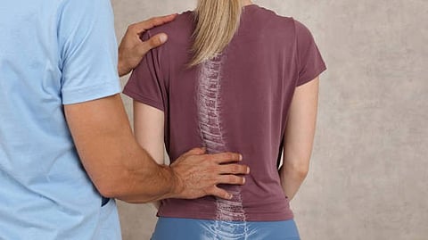 That includes young people with the most common form of spinal curves: adolescent idiopathic scoliosis. [Pixabay]