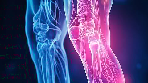 Joint Pains[Pixabay]