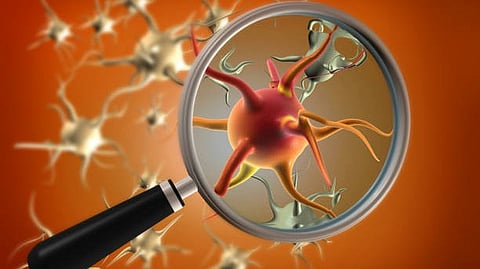 Bacteria are microscopic murderers. [Pixabay]