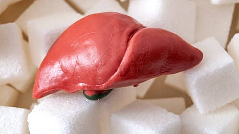 The image shows a human liver model placed on a white surface.