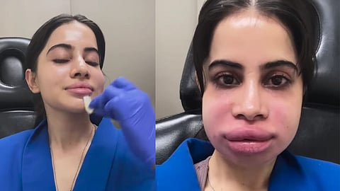 A woman wearing a blue coat, prominently featuring a large nose, stands confidently against a neutral background.