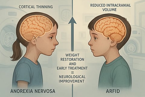 By comparing the brains of children with anorexia nervosa to those with ARFID, the researchers demonstrated that the neurological impact of these disorders