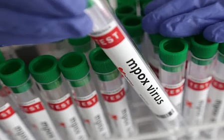 WHO says mpox no longer a global public health emergency


