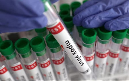  More mpox cases reported in Malawi with capital Lilongwe topping national count