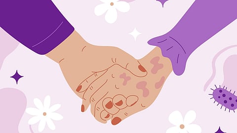 Two hands are joint their hands have spots showcasing the disease leprosy and round those hands are flowers and bacteria elements