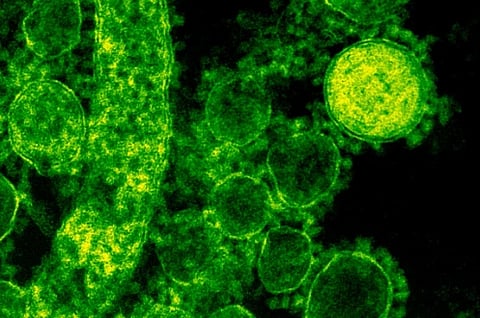 Fluorescent green viral particles on a black background, resembling spheres and irregular shapes. The image conveys a scientific, microscopic view.