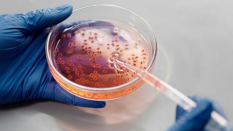 Gloved hands hold a petri dish with a pinkish-orange liquid and small round particles. A pipette is inserted, suggesting a laboratory setting.