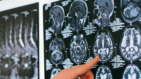 A hand in a white coat points to brain MRI scans on a lightbox. The scene conveys analysis and focus, highlighting medical and scientific examination.
