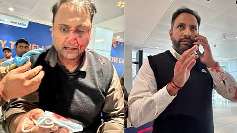 Two men with visible injuries stand indoors. The man on the left is passenger Ankit Dewan with blood on his face and holds a phone. The man on the right is Air India Express captain Virender Sejwal, speaking on a phone, also with blood on his shirt.