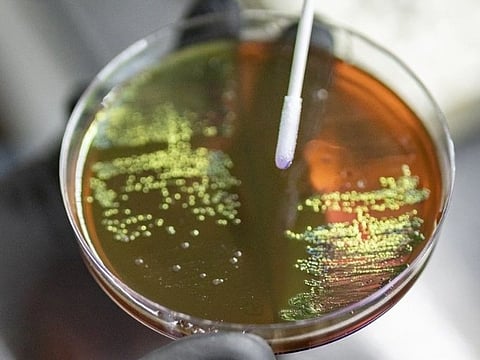 A gloved hand holds a Petri dish showing green bacterial colonies on a dark brown agar surface. A swab touches the agar, suggesting lab work.