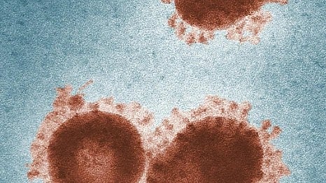 Microscopic image showing four round, brownish-red virus particles with spiky edges on a textured blue background, resembling a coronavirus.