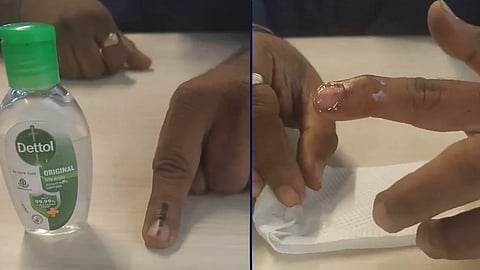 Screenshots from a video showing someone removing the ink from their finger using sanitizer after the Maharashtra Municipal Corporation Election.