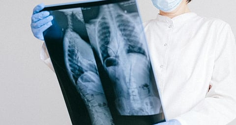 A healthcare professional wearing a mask and gloves examines an X-ray, appearing focused and analytical. The setting is clinical and professional.