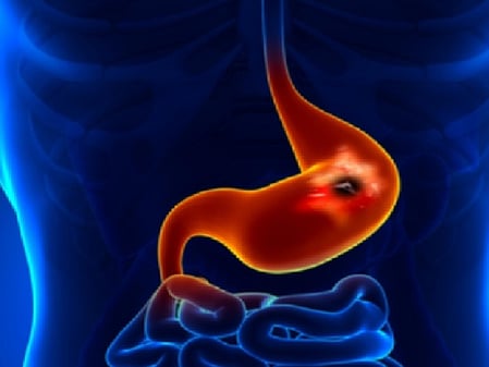 “लाइफ कंट्रोल सेंटर” है पैंक्रियास, अनदेखा करना होगा सेहत के साथ खिलवाड़