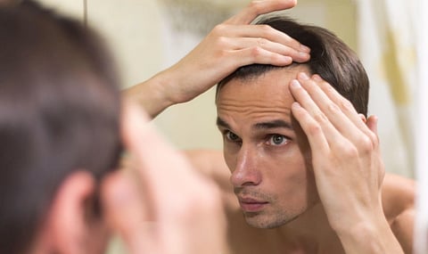 A man closely examines his hairline in a bathroom mirror, appearing concerned. He uses both hands to part his hair, focusing on a potential receding hairline.