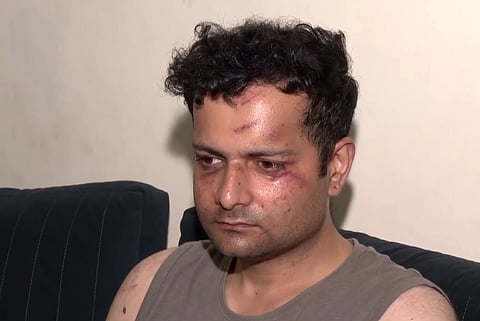 Today, on July 24, 2026,  the Cockroach Janata Party (CJP) called for a nationwide protest.