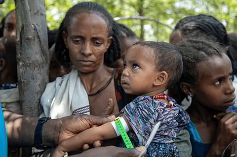 United Nations reports millions of people are suffering from acute hunger, with some 400,000 on the verge of famine. voa