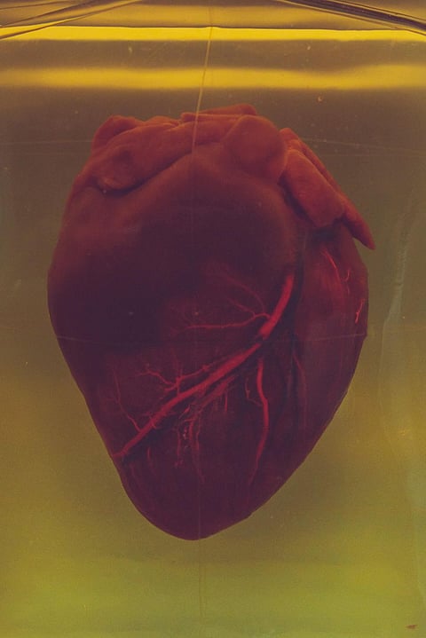 8 Risk Factors That Can Develop Heart Failure in Future