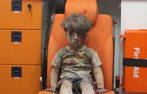 Ten-year-old Syrian Boy Ali Daqneesh Dies of his Wounds in Aleppo